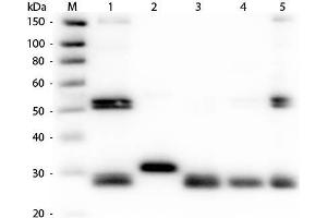Western Blot of Anti-Rat IgG (H&L) (RABBIT) Antibody (Min X Human Serum Proteins).