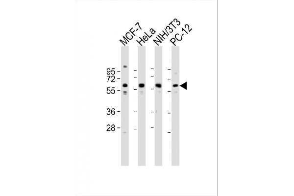 Pyruvate Kinase Antikörper  (N-Term)