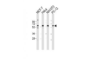 Western Blot at 1:2000 dilution Lane 1: MCF-7 whole cell lysates Lane 2: Hela whole cell lysates Lane 3: NIH/3T3 whole cell lysates Lane 4: PC-12 whole cell lysates Lysates/proteins at 20 ug per lane. (Pyruvate Kinase Antikörper  (N-Term))