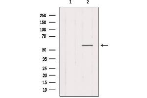 Western blot analysis of extracts from Mouse muscle, using CHRNG Antibody.