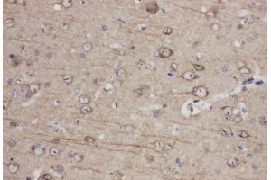 Immunohistochemistry (IHC) image for anti-Ephrin Type A Receptor 1 (EPHA1) (AA 963-976), (C-Term) antibody (ABIN3044443)
