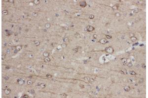 Anti-Eph receptor A1 antibody, IHC(P) IHC(P): Rat Brain Tissue (EPHA1 Antikörper  (C-Term))
