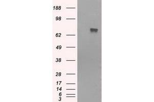 Western Blotting (WB) image for anti-Bruton Agammaglobulinemia tyrosine Kinase (BTK) antibody (ABIN1496971) (BTK Antikörper)