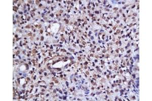 Formalin-fixed and paraffin embedded human endometrium tissue labeled with Anti-phospho-AKT/PKB(Ser473) Polyclonal Antibody, Unconjugated  at 1:200, followed by conjugation to the secondary antibody and DAB staining (AKT 1/2/3 Antikörper  (pSer473))