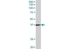 ACADS MaxPab polyclonal antibody.