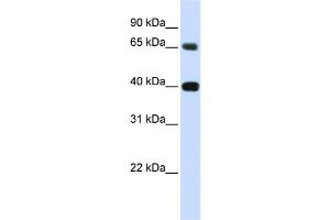 Western Blotting (WB) image for anti-Thymopoietin (TMPO) antibody (ABIN2458894)