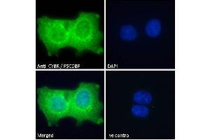 ABIN184711 Immunofluorescence analysis of paraformaldehyde fixed A431 cells, permeabilized with 0.