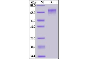 SDS-PAGE (SDS) image for Guanylate Cyclase 2C (Heat Stable Enterotoxin Receptor) (GUCY2C) (AA 24-430) (Active) protein (His tag) (ABIN7013472)