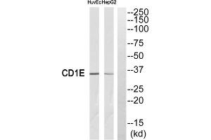Western blot analysis of extracts from HuvEc cells and HepG2 cells, using CD1E antibody. (CD1e Antikörper  (Internal Region))