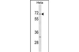 Western blot analysis in Hela cell line lysates (35ug/lane). (STK3 Antikörper  (C-Term))