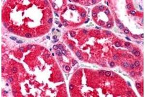 Immunohistochemistry (IHC) image for anti-Aldo-Keto Reductase Family 1, Member B1 (Aldose Reductase) (AKR1B1) antibody (ABIN5912019) (AKR1B1 Antikörper)