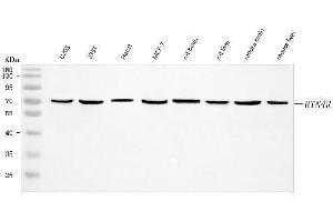 Western blot analysis of Nogo Receptor/NgR1/RTN4R using anti-Nogo Receptor/NgR1/RTN4R antibody (ABIN7602041).