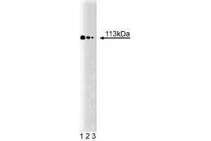 Western Blotting (WB) image for anti-Signal Transducer and Activator of Transcription 2, 113kDa (STAT2) (AA 1-178) antibody (ABIN967806)