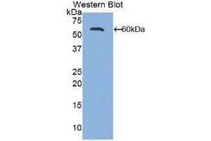 Detection of Recombinant ALCAM, Mouse using Polyclonal Antibody to Activated Leukocyte Cell Adhesion Molecule (ALCAM) (CD166 Antikörper  (AA 28-527))