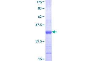 CD11b Protein (AA 111-220) (GST tag)