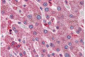 Liver: Formalin-Fixed, Paraffin-Embedded (FFPE) (HYAL1 Antikörper  (AA 325-339))