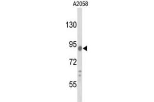 Western Blotting (WB) image for anti-Component of Oligomeric Golgi Complex 4 (COG4) antibody (ABIN3003206) (COG4 Antikörper)