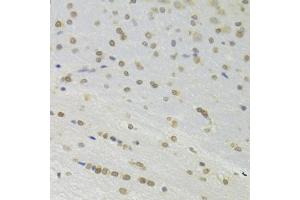 Immunohistochemistry of paraffin-embedded rat brain using DOK1 Antibody (ABIN6130881, ABIN6139763, ABIN6139764 and ABIN6221343) at dilution of 1:100 (40x lens). (DOK1 Antikörper  (AA 1-280))