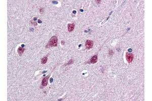 Image no. 1 for anti-Single-Strand-Selective Monofunctional Uracil-DNA Glycosylase 1 (SMUG1) (N-Term) antibody (ABIN372862) (SMUG1 Antikörper  (N-Term))