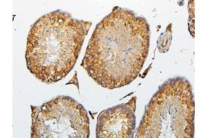 IHC analysis of CRB1 using anti-CRB1 antibody (ABIN6719658).