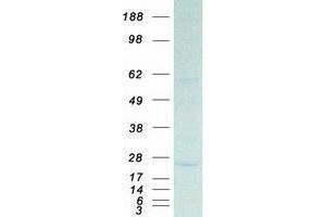 Transmembrane Protein 70 (TMM70) (Transcript Variant 1) protein (Myc-DYKDDDDK Tag)