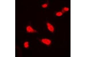 Immunofluorescent analysis of BAP1 staining in Hela cells. (BAP1 Antikörper)
