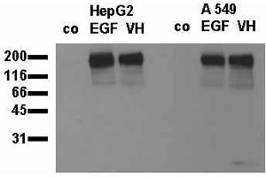 Phosphospecificity: Whole cell extracts of control (co), EGF stimulated (EGF) or pervanadate treated (VH) HepG2 and A549 tumor cells were applied to SDS-PAGE (20,000 cells per lane) and transferred to a PVDF membrane. (EGFR Antikörper  (pTyr845))
