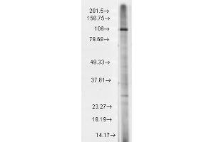 Western Blot analysis of Rat brain membrane lysate showing detection of TrpC7 protein using Mouse Anti-TrpC7 Monoclonal Antibody, Clone S64A-36 . (TRPC7 Antikörper  (AA 845-862) (Atto 390))