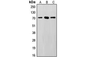Western blot analysis of SENP3 expression in HeLa (A), MCF7 (B), Saos2 (C) whole cell lysates.