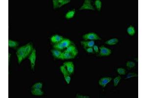 Immunofluorescent analysis of Hela cells using ABIN7165534 at dilution of 1:100 and Alexa Fluor 488-congugated AffiniPure Goat Anti-Rabbit IgG(H+L) (FAM71A Antikörper  (AA 381-594))