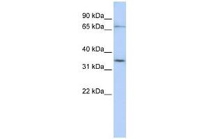 SLCO1C1 antibody used at 1 ug/ml to detect target protein. (SLCO1C1 Antikörper  (N-Term))