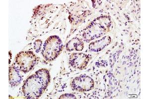 Formalin-fixed and paraffin embedded rat colitis tissue labeled with Anti CD98 Polyclonal Antibody, Unconjugated  at 1:200 followed by conjugation to the secondary antibody and DAB staining (SLC3A2 Antikörper  (AA 231-280))