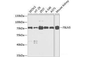 Western blot analysis of extracts of various cell lines using FBLN5 Polyclonal Antibody at dilution of 1:1000.