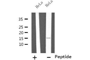 Western blot analysis of extracts from HeLa cells, using IL4 antibody. (IL-4 Antikörper  (Internal Region))