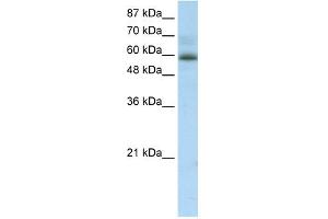 WB Suggested Anti-ZNF307 Antibody Titration:  2. (ZKSCAN4 Antikörper  (Middle Region))