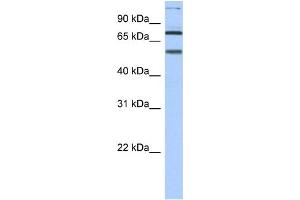 WB Suggested Anti-DLL4 Antibody Titration: 0. (DLL4 Antikörper  (N-Term))