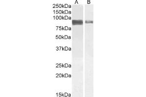 ABIN5539499 (1 μg/mL) staining of Jurkat (A) and (2 μg/mL) A431 (B) cell lysate (35 μg protein in RIPA buffer). (CRTC2 Antikörper  (C-Term))