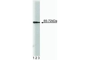 Western blot analysis of SHP2 (PTP1D) on a Jurkat cell lysate (Human T-cell leukemia, ATCC TIB-152). (PTPN11 Antikörper  (AA 1-177))