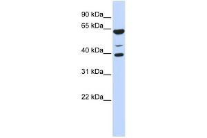WB Suggested Anti-ZNF764 Antibody Titration: 0. (ZNF764 Antikörper  (N-Term))