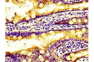 Immunohistochemistry of paraffin-embedded human small intestine tissue using ABIN7170569 at dilution of 1:100 (S1PR2 Antikörper  (AA 293-353))