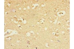 Immunohistochemistry of paraffin-embedded human brain tissue using ABIN7153488 at dilution of 1:100