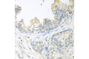 Immunohistochemistry of paraffin-embedded human prostate using CUL3 antibody (ABIN5970436) at dilution of 1/100 (40x lens). (Cullin 3 Antikörper)