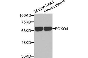 Western blot analysis of extracts of various cell lines, using FOXO4 antibody. (FOXO4 Antikörper  (AA 346-505))