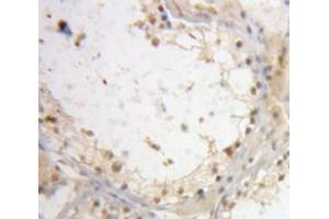 IHC-P analysis of Testis tissue, with DAB staining. (Interleukin enhancer-binding factor 3 (ILF3) (AA 672-891) Antikörper)
