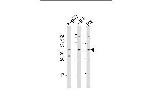 All lanes : Anti-FGFR1OP Antibody (Center) at 1:1000-1:2000 dilution Lane 1: HepG2 whole cell lysate Lane 2: K562 whole cell lysate Lane 3: Raji whole cell lysate Lysates/proteins at 20 μg per lane. (FGFR1OP Antikörper  (AA 183-214))