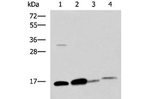 Western blot analysis of Human sigmoid tissue Mouse large intestine tissue Mouse small intestines tissue Mouse Pancreas tissue lysates using ZG16 Polyclonal Antibody at dilution of 1:800 (ZG16 Antikörper)