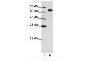 Image no. 1 for anti-Fragile X Mental Retardation, Autosomal Homolog 1 (FXR1) (AA 373-422) antibody (ABIN6736201) (FXR1 Antikörper  (AA 373-422))