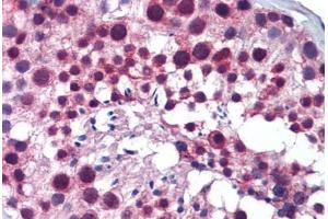Human Testis: Formalin-Fixed, Paraffin-Embedded (FFPE) (PLK1 Antikörper  (C-Term))