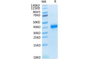 Human CD2/SRBC on Tris-Bis PAGE under reduced condition. (CD2 Protein (CD2) (His tag))
