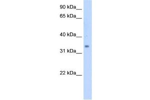 SC4MOL antibody used at 5 ug/ml to detect target protein.